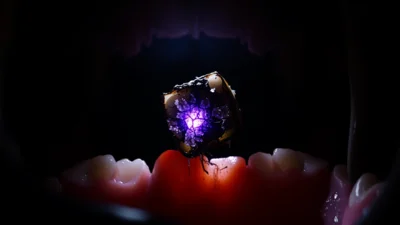 Sen o zkaženém zubu